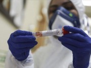 الصحة: حالتا وفاة و2637 إصابة جديدة بفيروس كورونا الأسبوع الماضي